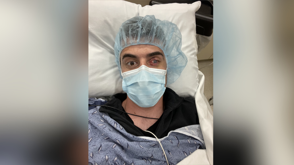 A photo of Nick as he is sat in a hospital bed following surgery. He is wearing a blue hair net and a blue face mask.